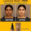 আপনার কি জেদি মেছতার সমস্যা? Licorice Root spot remove and Whitenin-সিরাম ত্বকের গভীর থেকে মেছতা দূর করে। ড্যামেজ সেলগুলো পুনরায় রিপিয়ার করে। ✅মেছতা দূর করে। ✅স্কিনের যেকোন দাগ দূর করে। ✅স্কিন উজ্জল ও ফর্সা করে। ✅রিংকেল ও বয়সের ছাপ দূর করে (Anti Aging) ✅স্কিনে সতেজ ও রিপিয়ার করে। 🛻সারাদেশে হোমডেলিভারি চলছে। প্রডাক্টি শুধু Certain Beauty BD তে পাবেন। প্রডাক্টির কার্যকারীতা পরিক্ষিত। WhatsApp/imo: 01763-136243 অর্ডার কনফার্ম করতে এখনই মেসেজ করুন।
