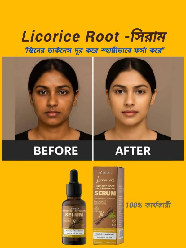 আপনার কি জেদি মেছতার সমস্যা? Licorice Root spot remove and Whitenin-সিরাম ত্বকের গভীর থেকে মেছতা দূর করে। ড্যামেজ সেলগুলো পুনরায় রিপিয়ার করে। ✅মেছতা দূর করে। ✅স্কিনের যেকোন দাগ দূর করে। ✅স্কিন উজ্জল ও ফর্সা করে। ✅রিংকেল ও বয়সের ছাপ দূর করে (Anti Aging) ✅স্কিনে সতেজ ও রিপিয়ার করে। 🛻সারাদেশে হোমডেলিভারি চলছে। প্রডাক্টি শুধু Certain Beauty BD তে পাবেন। প্রডাক্টির কার্যকারীতা পরিক্ষিত। WhatsApp/imo: 01763-136243 অর্ডার কনফার্ম করতে এখনই মেসেজ করুন।