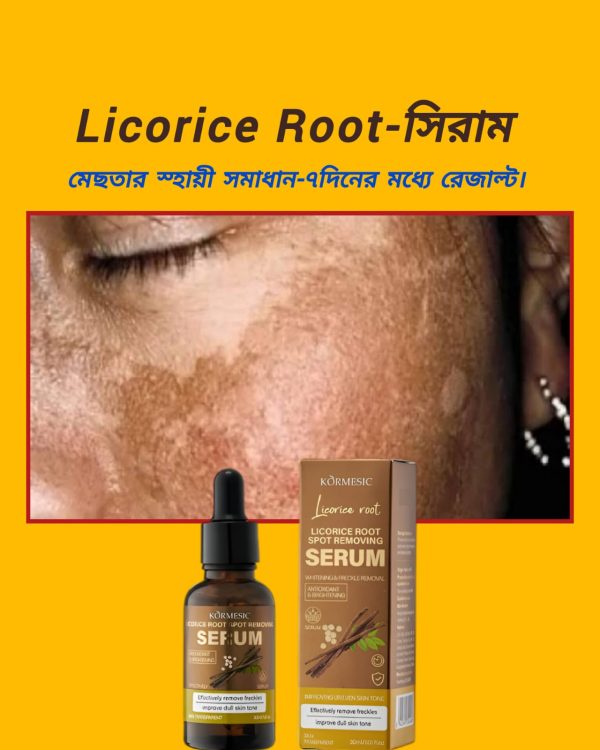 আপনার কি জেদি মেছতার সমস্যা? Licorice Root spot remove and Whitenin-সিরাম ত্বকের গভীর থেকে মেছতা দূর করে। ড্যামেজ সেলগুলো পুনরায় রিপিয়ার করে। ✅মেছতা দূর করে। ✅স্কিনের যেকোন দাগ দূর করে। ✅স্কিন উজ্জল ও ফর্সা করে। ✅রিংকেল ও বয়সের ছাপ দূর করে (Anti Aging) ✅স্কিনে সতেজ ও রিপিয়ার করে। 🛻সারাদেশে হোমডেলিভারি চলছে। প্রডাক্টি শুধু Certain Beauty BD তে পাবেন। প্রডাক্টির কার্যকারীতা পরিক্ষিত। WhatsApp/imo: 01763-136243 অর্ডার কনফার্ম করতে এখনই মেসেজ করুন।