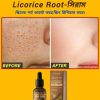 আপনার কি জেদি মেছতার সমস্যা? Licorice Root spot remove and Whitenin-সিরাম ত্বকের গভীর থেকে মেছতা দূর করে। ড্যামেজ সেলগুলো পুনরায় রিপিয়ার করে। ✅মেছতা দূর করে। ✅স্কিনের যেকোন দাগ দূর করে। ✅স্কিন উজ্জল ও ফর্সা করে। ✅রিংকেল ও বয়সের ছাপ দূর করে (Anti Aging) ✅স্কিনে সতেজ ও রিপিয়ার করে। 🛻সারাদেশে হোমডেলিভারি চলছে। প্রডাক্টি শুধু Certain Beauty BD তে পাবেন। প্রডাক্টির কার্যকারীতা পরিক্ষিত। WhatsApp/imo: 01763-136243 অর্ডার কনফার্ম করতে এখনই মেসেজ করুন।