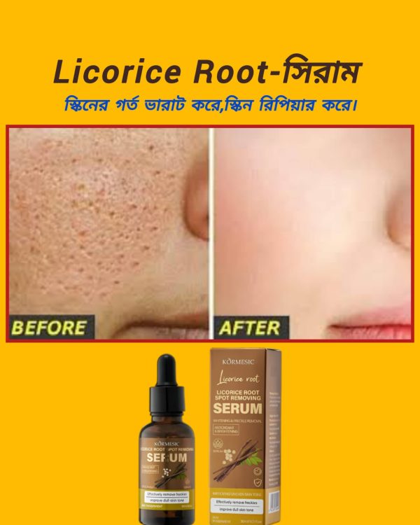 আপনার কি জেদি মেছতার সমস্যা? Licorice Root spot remove and Whitenin-সিরাম ত্বকের গভীর থেকে মেছতা দূর করে। ড্যামেজ সেলগুলো পুনরায় রিপিয়ার করে। ✅মেছতা দূর করে। ✅স্কিনের যেকোন দাগ দূর করে। ✅স্কিন উজ্জল ও ফর্সা করে। ✅রিংকেল ও বয়সের ছাপ দূর করে (Anti Aging) ✅স্কিনে সতেজ ও রিপিয়ার করে। 🛻সারাদেশে হোমডেলিভারি চলছে। প্রডাক্টি শুধু Certain Beauty BD তে পাবেন। প্রডাক্টির কার্যকারীতা পরিক্ষিত। WhatsApp/imo: 01763-136243 অর্ডার কনফার্ম করতে এখনই মেসেজ করুন।
